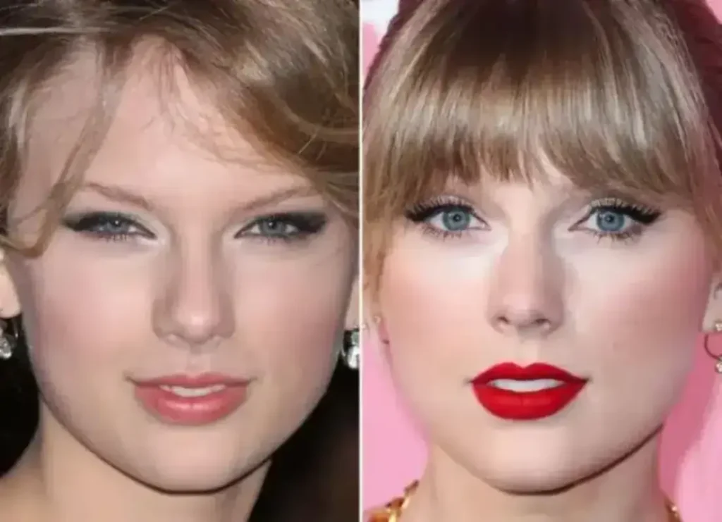 what plastic surgery has Taylor Swift had